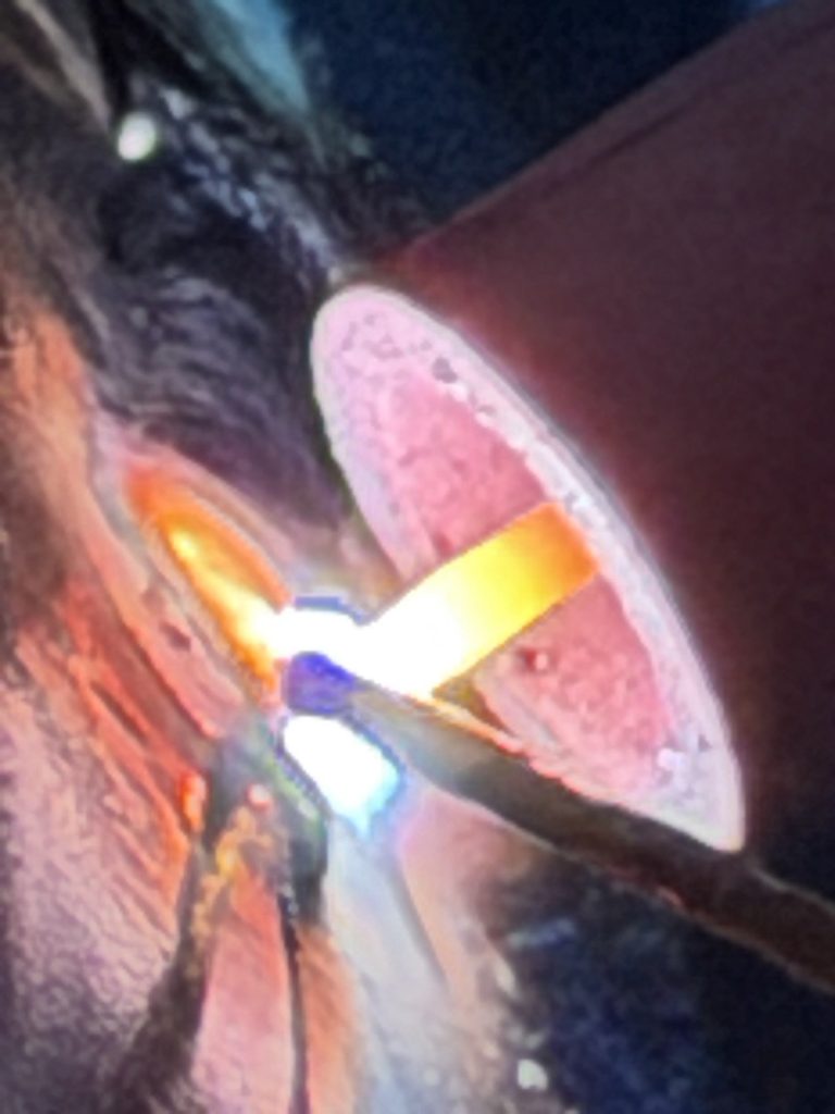 Nahaufnahme des WIG-Lichtbogens an der Rundnaht der Rohrwelle